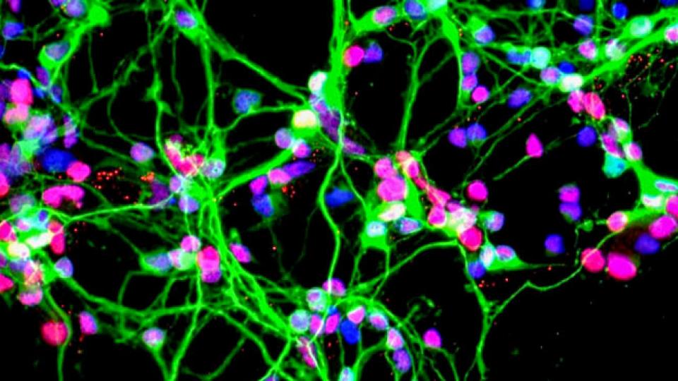 Neurons growing in a culture dish (NASA)