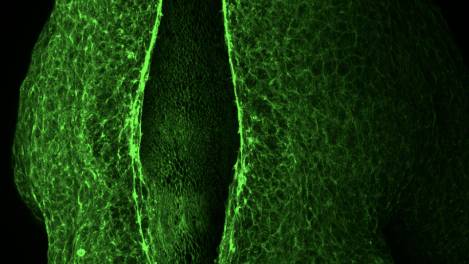 The neural tube