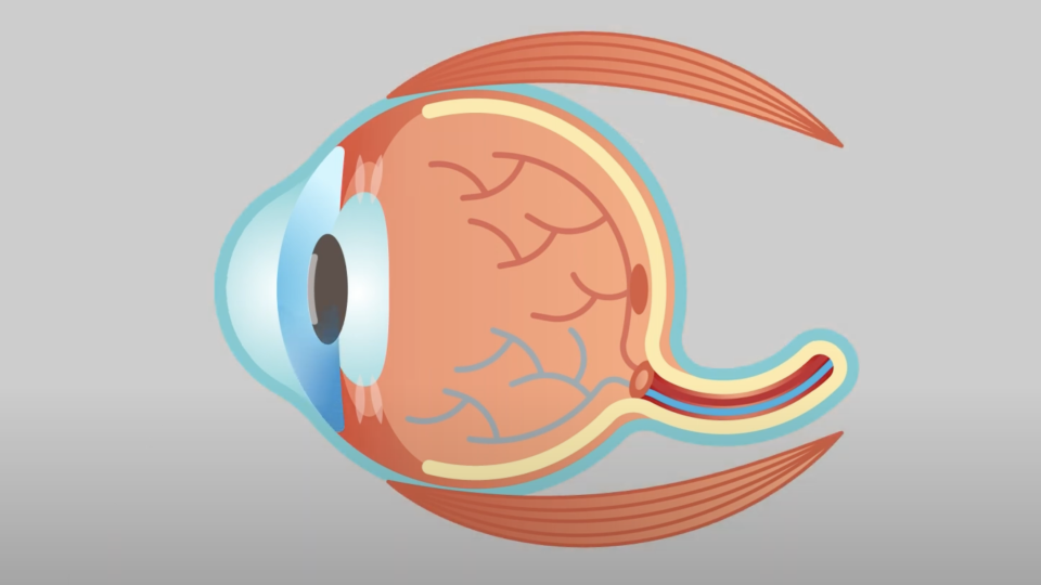 Eye