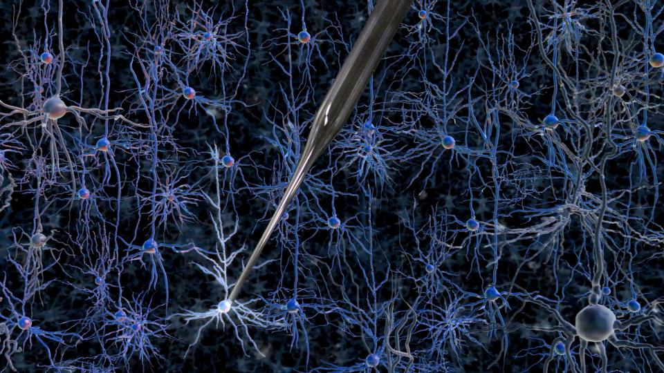 Craig Forest robotic neural recordings