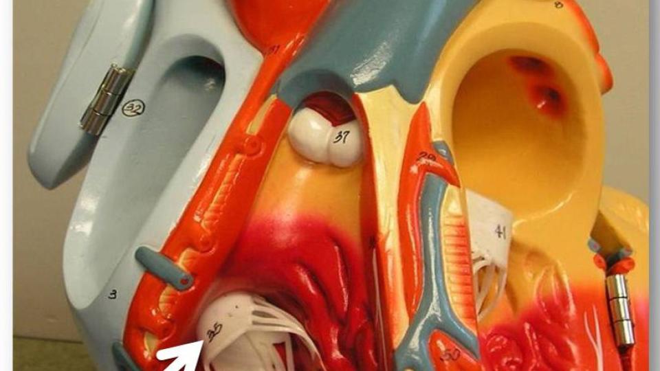 Tricuspid valve2