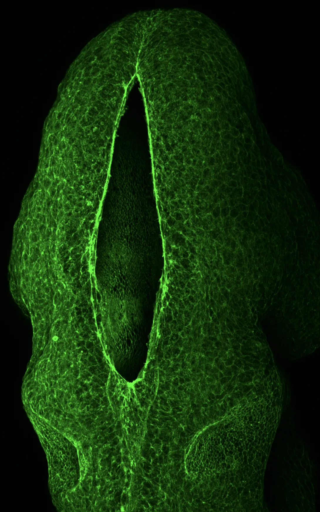 The neural tube