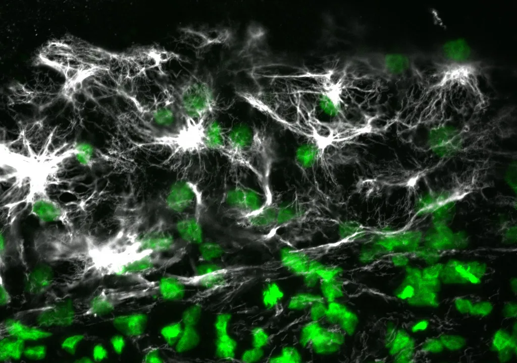 vimentin expression