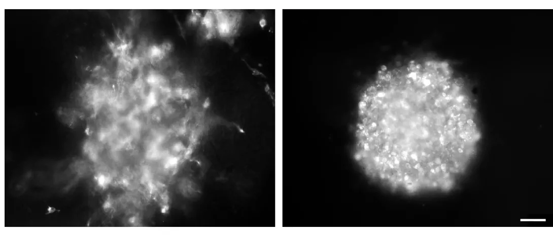 Imipramine blue inhibits glioblastoma cells